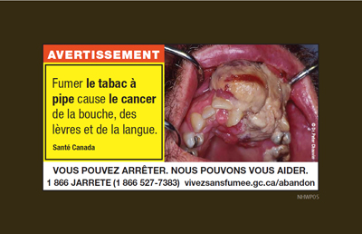 Figure 12a. La version textuelle suit.